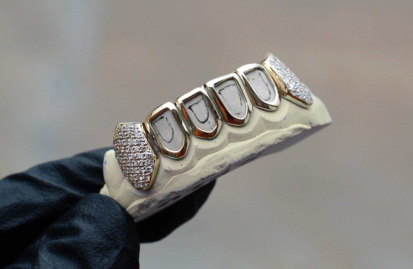 Womens Gold Grillz: Dazzling Designs | Shop the Hottest Trends Today